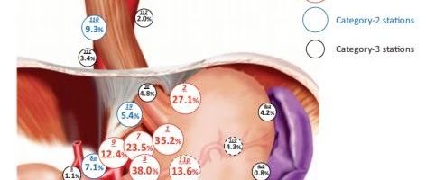日本食管协会和胃癌协会最新研究：食管胃交界部癌的术式和淋巴结清扫范围